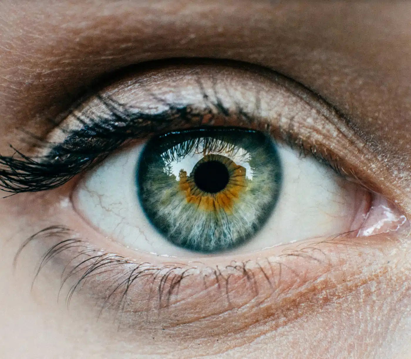 LASIK : déroulement de l’intervention étape par étape